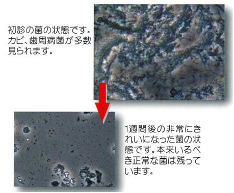 顕微鏡検査と薬による治療の変化