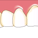 1．歯や歯肉の状態をチェック