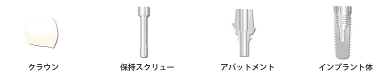 インプラント組織図