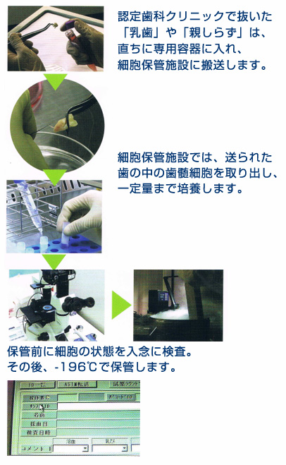 採取した歯髄細胞は培養・長期冷凍保管します
