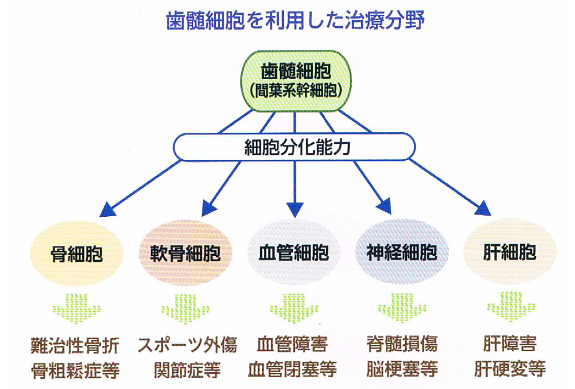 歯髄細胞バンクの将来性