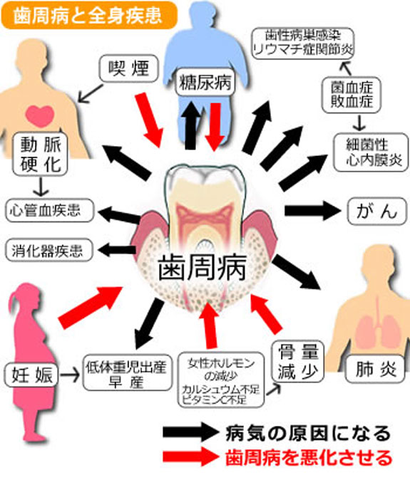 全身の健康は歯と口から